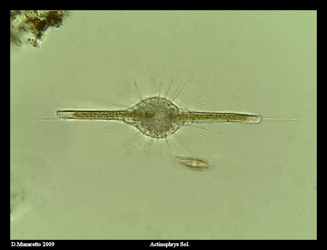 Actinophrys VS Diatomea...